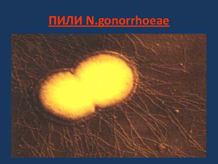 ПИЛИ N. gonorrhoeae 