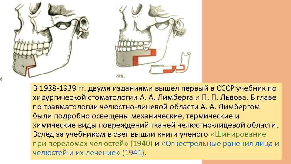 В 1938 -1939 гг. двумя изданиями вышел первый в СССР учебник по хирургической стоматологии