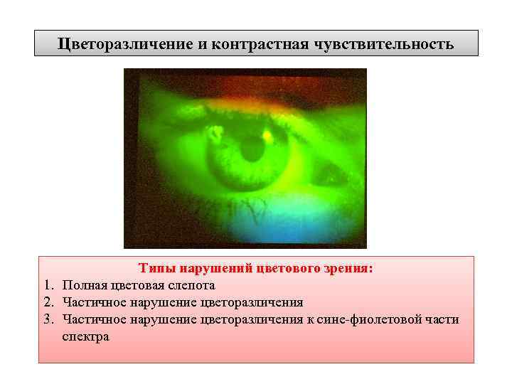 Цветоразличение и контрастная чувствительность Типы нарушений цветового зрения: 1. Полная цветовая слепота 2. Частичное