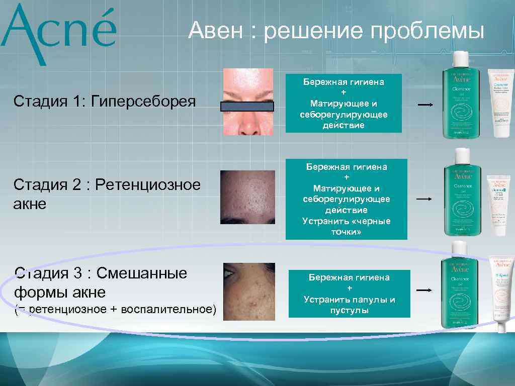 Авен : решение проблемы Стадия 1: Гиперсеборея Стадия 2 : Ретенциозное акне Стадия 3