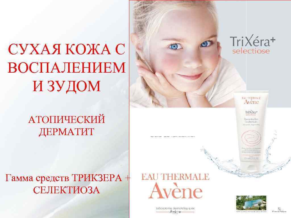 СУХАЯ КОЖА С ВОСПАЛЕНИЕМ И ЗУДОМ АТОПИЧЕСКИЙ ДЕРМАТИТ Гамма средств ТРИКЗЕРА + СЕЛЕКТИОЗА 