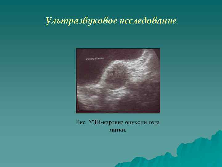 Ультразвуковое исследование 
