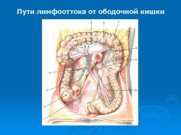 Пути лимфооттока от ободочной кишки 