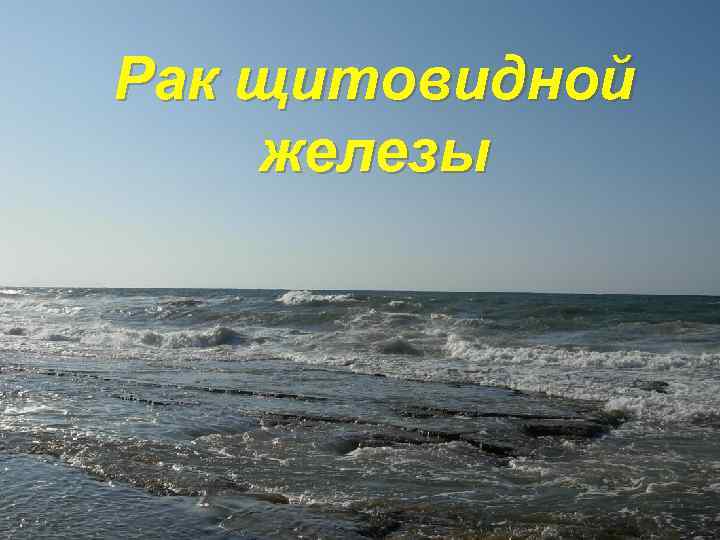 Рак щитовидной железы 