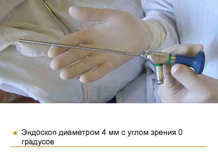 n Эндоскоп диаметром 4 мм с углом зрения 0 градусов 