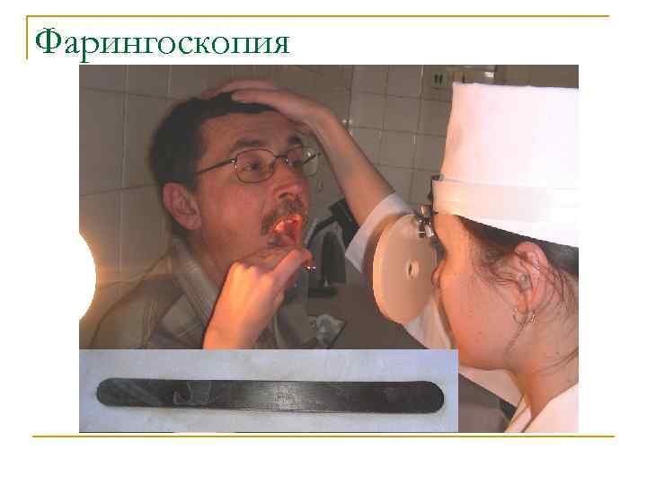 Фарингоскопия 