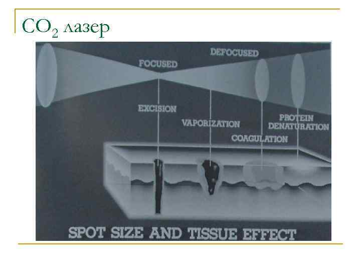 CO 2 лазер 