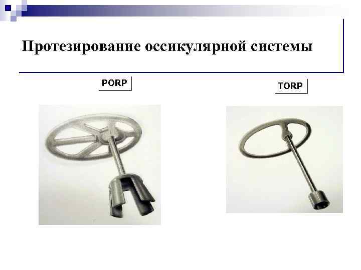 Протезирование оссикулярной системы PORP TORP 