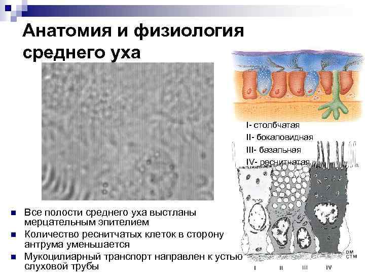 Анатомия и физиология среднего уха I- столбчатая II- бокаловидная III- базальная IV- реснитчатая n