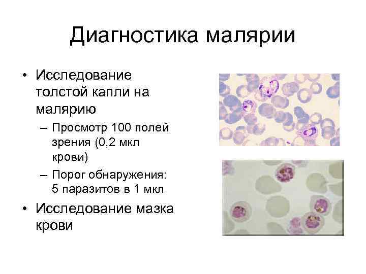 Кровь на малярию. Малярийный плазмодий мазок толстой крови. Микроскопия толстой капли крови. Исследование толстой капли крови на малярию. Малярийный плазмодий толстая капля.