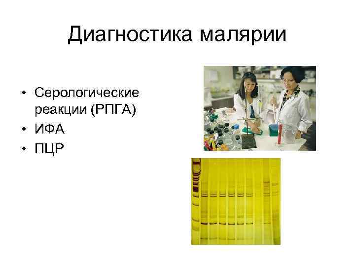 Диагностика малярии • Серологические реакции (РПГА) • ИФА • ПЦР 