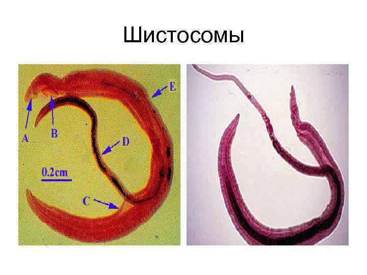 Шистосома. Schistosoma japonicum строение.