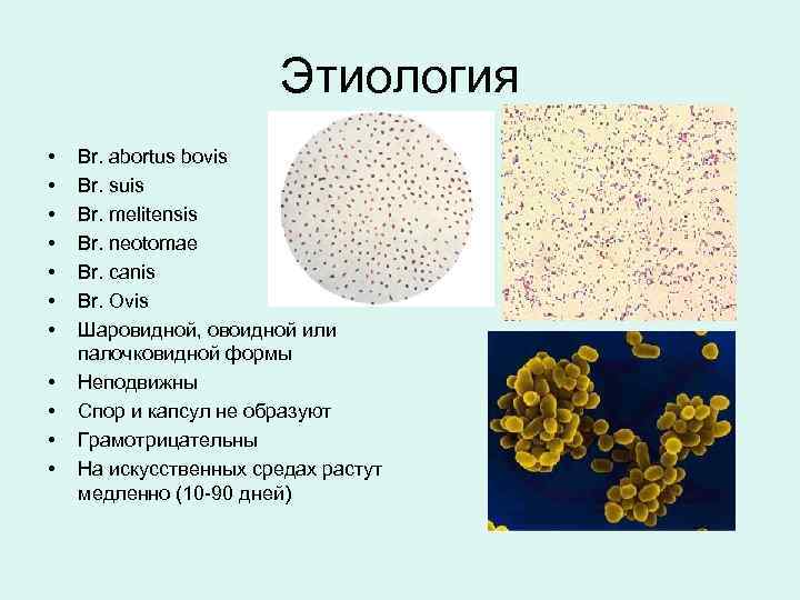 Этиология • • • Br. abortus bovis Br. suis Br. melitensis Br. neotomae Br.