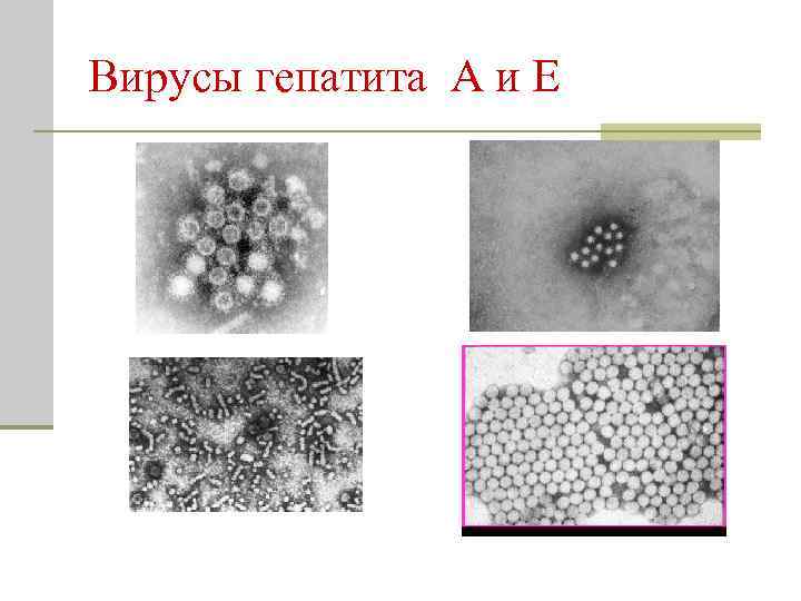 Вирусы гепатита А и Е 