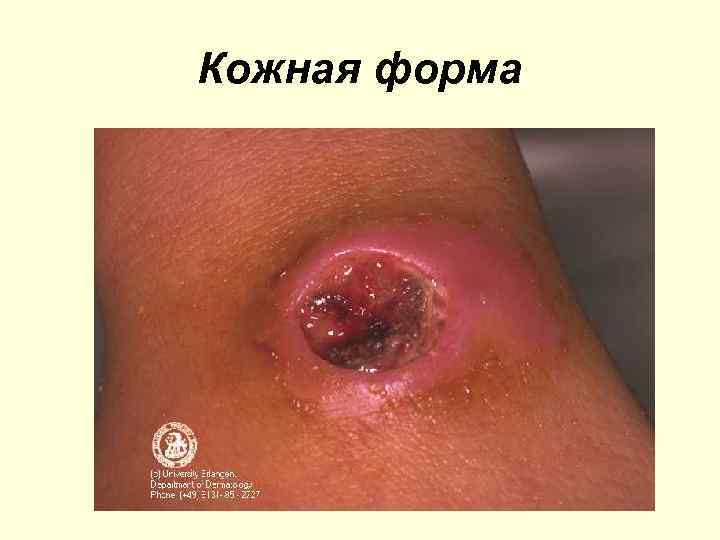Кожная форма 
