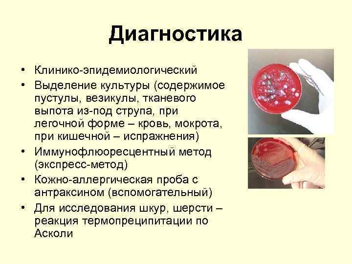 Диагностика • Клинико-эпидемиологический • Выделение культуры (содержимое пустулы, везикулы, тканевого выпота из-под струпа, при
