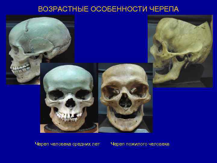 Костные ткани черепа. Формы черепа человека. Форма черепа у взрослого человека. Форма костей черепа. Возрастные изменения черепа.