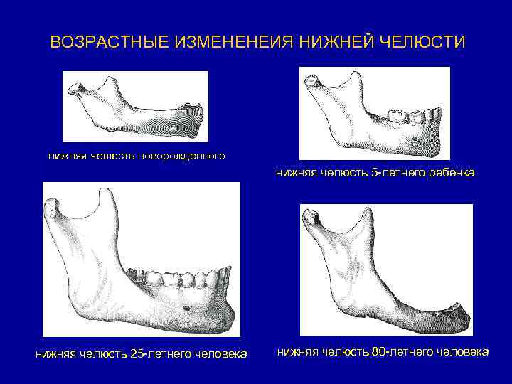 Тяжелая нижняя челюсть большой рот и короткий вздернутый нос фото