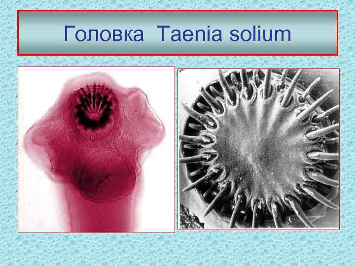 Головка Taenia solium 