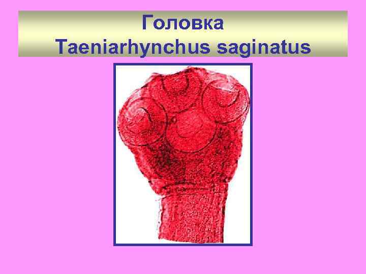 Головка Taeniarhynchus saginatus 
