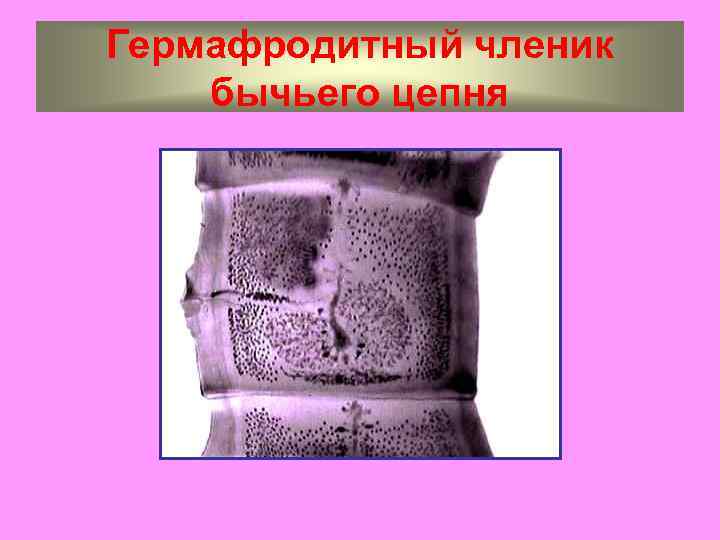 Гермафродитный членик бычьего цепня 