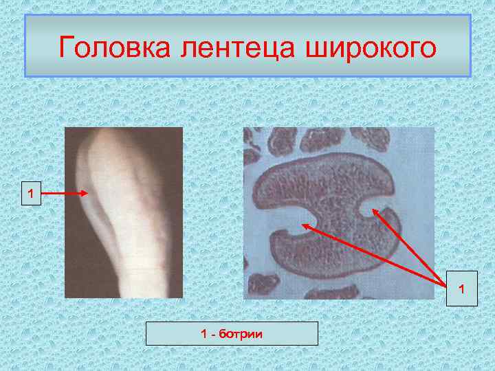 Головка лентеца широкого 1 1 1 - ботрии 