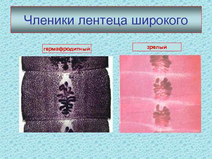 Членики лентеца широкого гермафродитный зрелый 