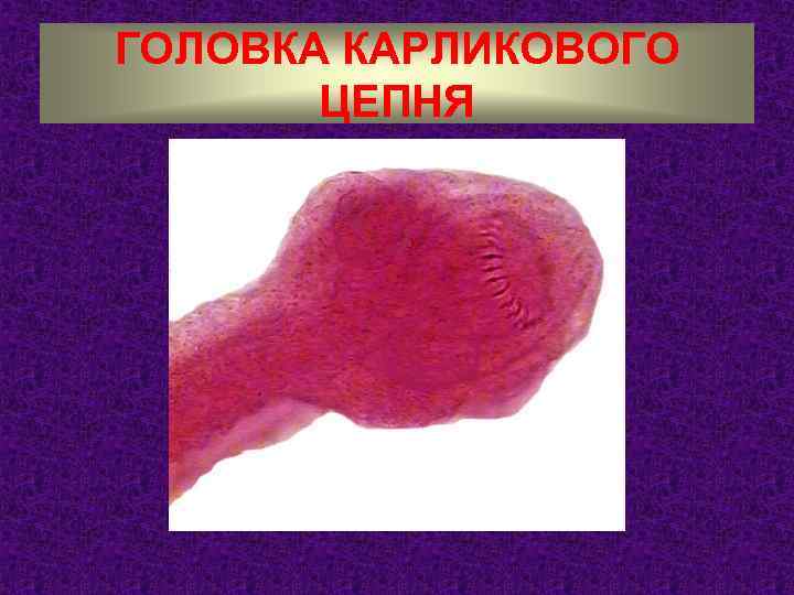 ГОЛОВКА КАРЛИКОВОГО ЦЕПНЯ 