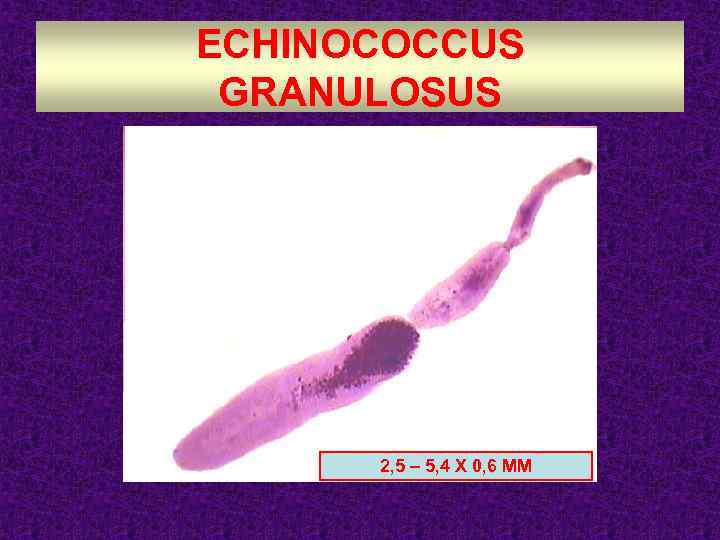 ECHINOCOCCUS GRANULOSUS 2, 5 – 5, 4 Х 0, 6 ММ 