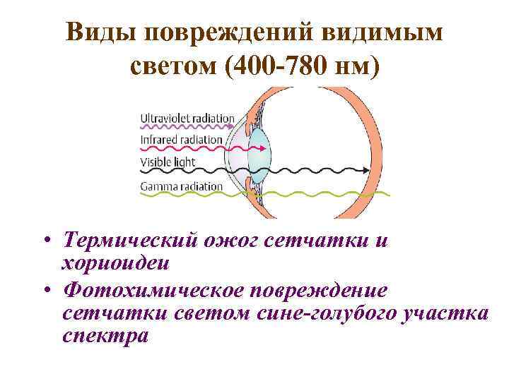 Виды повреждений видимым светом (400 -780 нм) • Термический ожог сетчатки и хориоидеи •