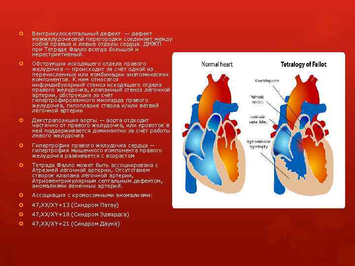  Вентрикулосептальный дефект — дефект межжелудочковой перегородки соединяет между собой правые и левые отделы