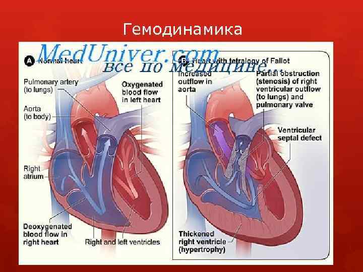 Гемодинамика 