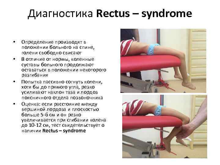 Диагностика Rectus – syndrome • • Определение производят в положении больного на спине, голени