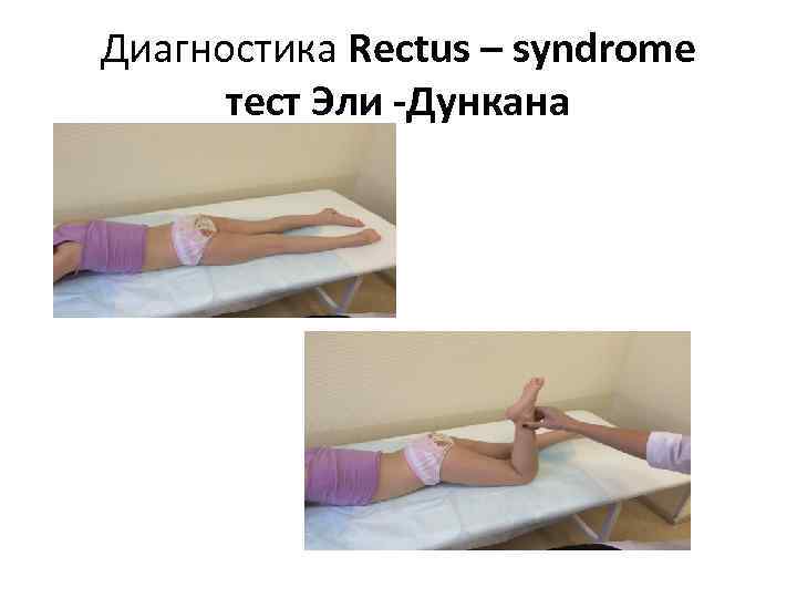 Диагностика Rectus – syndrome тест Эли -Дункана 