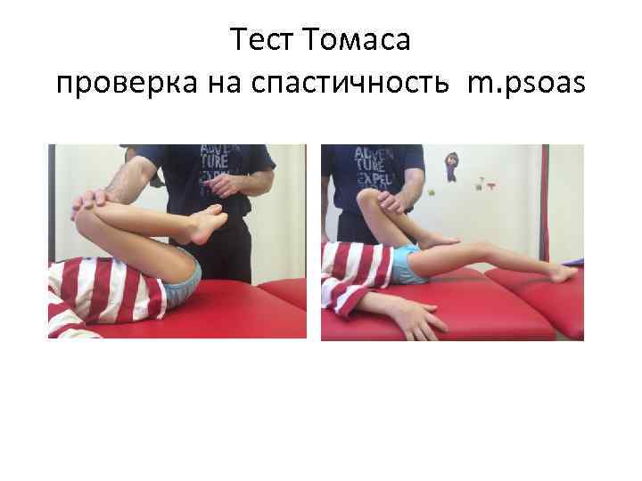Тест Томаса проверка на спастичность m. psoas 