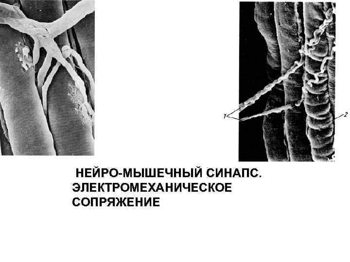  НЕЙРО-МЫШЕЧНЫЙ СИНАПС. ЭЛЕКТРОМЕХАНИЧЕСКОЕ СОПРЯЖЕНИЕ 