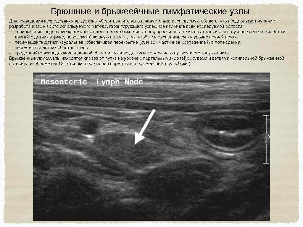 На узи увеличен. Мезентериальные лимфатические узлы в брюшной полости УЗИ. УЗИ мезентериальных лимфоузлов протокол. Забрюшинные лимфатические узлы на УЗИ. Мезентериальные лимфоузлы на УЗИ.