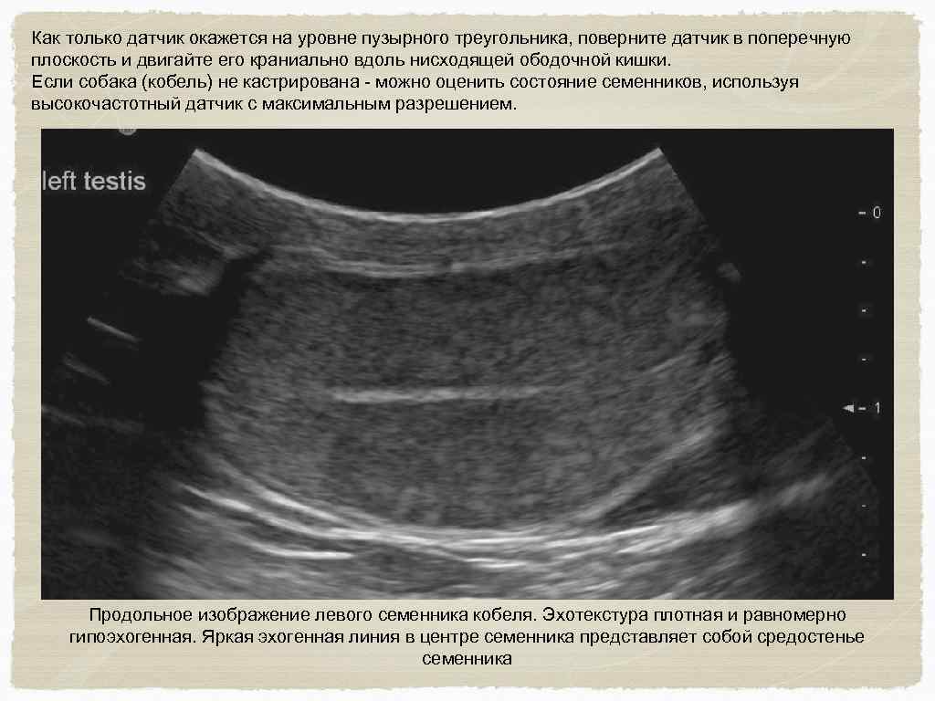 Как только датчик окажется на уровне пузырного треугольника, поверните датчик в поперечную плоскость и