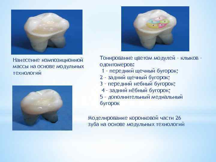 Нанесение композиционной массы на основе модульных технологий Тонирование цветом модулей – клыков – одонтомеров: