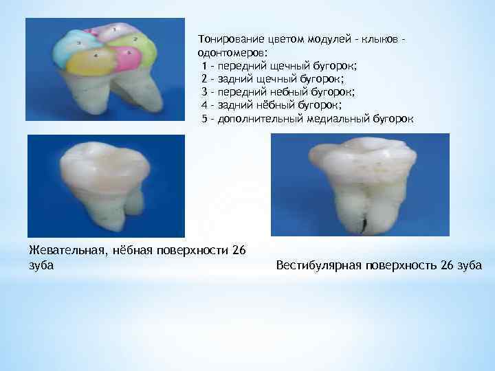 Тонирование цветом модулей – клыков – одонтомеров: 1 – передний щечный бугорок; 2 –