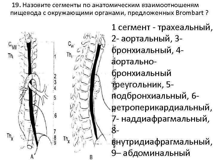 Сегменты пищевода по бромбару схема