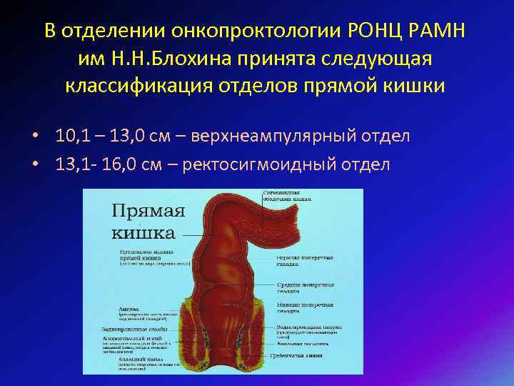 В отделении онкопроктологии РОНЦ РАМН им Н. Н. Блохина принята следующая классификация отделов прямой