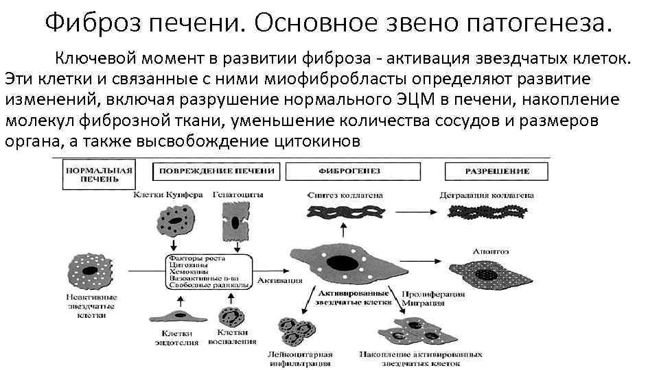 Фиброз печени. Основное звено патогенеза. Ключевой момент в развитии фиброза - активация звездчатых клеток.