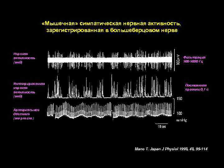  «Мышечная» симпатическая нервная активность, зарегистрированная в большеберцовом нерве Нервная активность (мк. В) Интегрированная