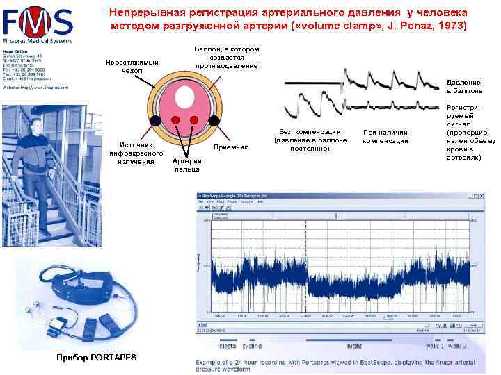 Непрерывная регистрация артериального давления у человека методом разгруженной артерии ( «volume clamp» , J.