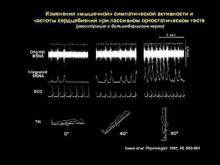 Изменения «мышечной» симпатической активности и частоты сердцебиений при пассивном ортостатическом тесте (регистрация в большеберцовом