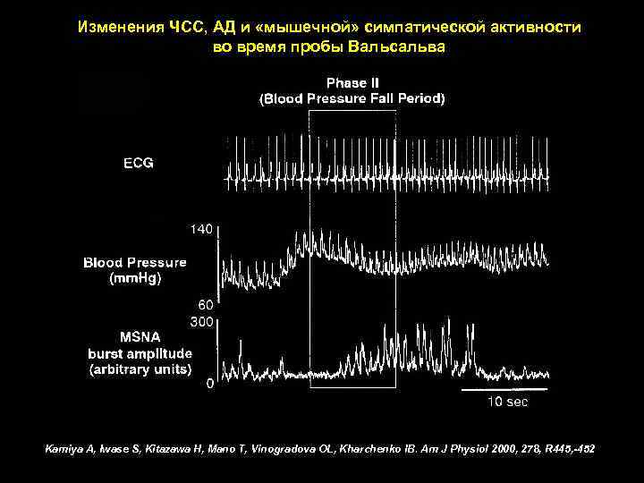 Изменения ЧСС, АД и «мышечной» симпатической активности во время пробы Вальсальва Kamiya A, Iwase