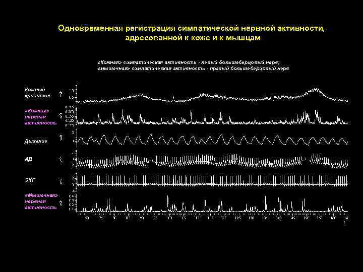 Одновременная регистрация симпатической нервной активности, адресованной к коже и к мышцам «Кожная» симпатическая активность