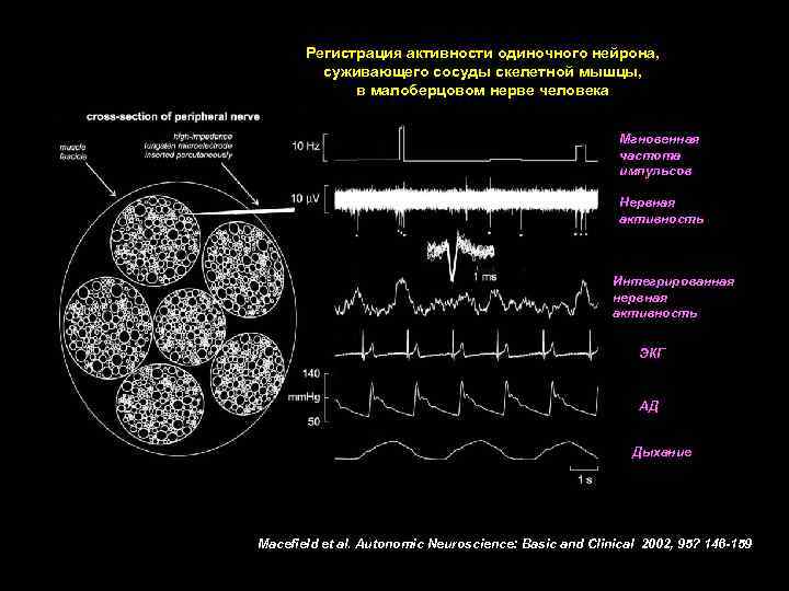Регистрация активности одиночного нейрона, суживающего сосуды скелетной мышцы, в малоберцовом нерве человека Мгновенная частота