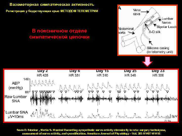 Вазомоторная симпатическая активность Регистрация у бодрствующих крыс МЕТОДОМ ТЕЛЕМЕТРИИ В поясничном отделе симпатической цепочки